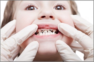 حشوات للأسنان من الخلايا الجذعية تجعلها تشفى من تلقاء نفسها