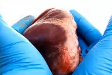 هناك شبه كبير بين عمل المضخة وعمل القلب،