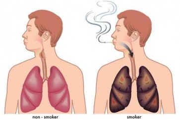 كيف تنظف رئتيك من سموم التدخين في 3 أيام فقط؟