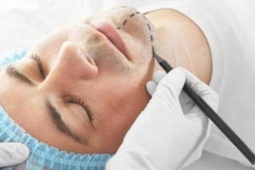 رقم هائل.. كم هو عدد الرجال العرب الذين يقبلون على عمليات التجميل؟