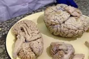 العلماء يحددون مركز التسامح في دماغ الإنسان