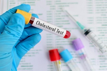 Cholesterol Test