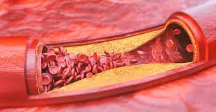 Arteries Tassalob1